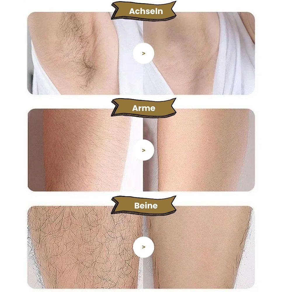 Epilator - Haarentferner